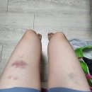 김정배이비인후과의원 | 20220718~20220724