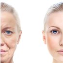 코코피부 이미지