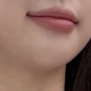 아르필의원