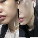 안나로자 에스큐어 크림 찐 임상후기, 거칠어진 피부 다들어와!