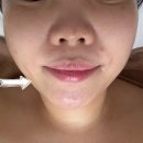 죽봉대로 | [광주] 광주윤곽관리 리큐브에스테틱(웨딩관리추천)