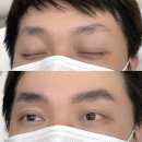 청주 눈썹문신 잘하는 곳 리메이드 후기