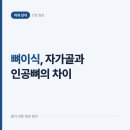 가정백세플란트치과의원 | 임플란트 전에 하는 뼈이식, 자가골과 인공뼈는 무엇이 다를까
