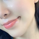 매일25시약국 | 약국 기미크림 추천 색소침착 효과 좋은 기미크림 내돈내산