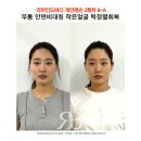 삼성동-2 | [공지] 무통 안면비대칭 교정, 단 2회로 얼굴 정렬 회복한 후기 (삼성동필라테스 리마인드바디)