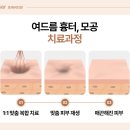 홍제피부관리