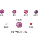 재생불량빈혈 Aplastic anemia 이미지