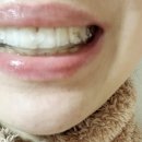 디메디코리아 이미지