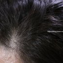 고피지에이