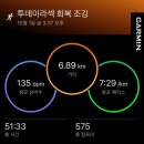 스마일독 | 스마일라식 7년차 시력떨어져서 투데이라섹으로 재수술한 후기(ㅇㅇㅅ안과)