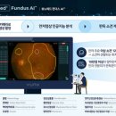 뷰노 이미지