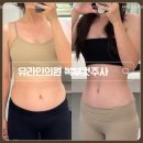 6전6회 | 출산 후 복부 라인 고민 끝! 유라인 지방분해주사 복부컷주사 6회차 전/후 후기 완전 정리