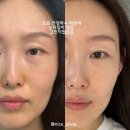 니오라코리아 | [공지] 니오라 세럼 11월 한국 출시 5일만에 완판! 핵심성분과 1병 쓴 사용후기