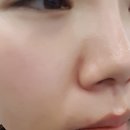 스피드메디