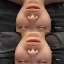 청진네오스빌 | 구월동피부관리 예비신부 윤곽관리로 얼굴 밸런스 잡아준 에스테티아 인천구월점 후기