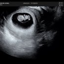 이천제일의원 네이버블로그