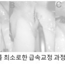 솔 치과기공소 이미지