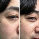 김소영스킨케어 | 건성피부관리 웰니스루틴 30분 케어 올레팩(올리브+레몬팩) 효능 EVOO 후기