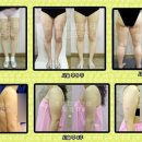 메디칼포유 이미지