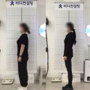 자세 개선 필라테스 A | 홍대 필라테스 1위 / *10년간 수천명을 변화시킨* 체형·통증·라인 개선 전문 업체!