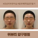 강남피부관리실 발로 빚는 특별한 윤곽관리 위뷰티압구정점