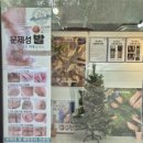 GS25경산사동점 | 경산 내성발톱 무좀발톱전문 치유네일에서 통증관리후기