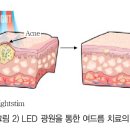 김진태한의원 | 오목교한의원 - 요즘 핫한 프라엘에 대하여~
