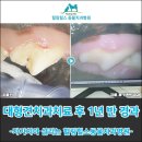 힐링힐스 동물 치과병원 | 대형견치과치료 후 1년 반이 지나 구강검진 왔어요! - 힐링힐스동물치과병원-