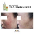 토픽피부관리실