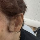 다비치 보청기 히어링 인천연수점 이미지