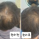두피탈모태후사랑아주점 이미지