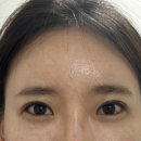 볼륨2 티스토리