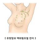 유방암Breast cancer유방내분비질환, 종양혈액질환 이미지