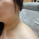 셀플러스의원 네이버블로그