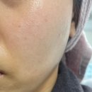 요즘 핫한 화장품 인셀덤 크림 후기