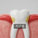 수완더치과병원 | 광주 수완지구동물병원, 전신 건강에 영향을 미치는 강아지 치은염