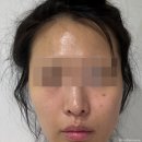 준 - 울주군 보곡2길 14 | 압구정피부과 콜라겐스킨부스터 올리디아 피부모공 쪼여준 후기