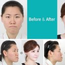 렛미인 - 서구 도안동 | 렛미인