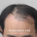 제이제이서연외과의원 네이버블로그