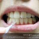 임플라인 치과의원 이미지