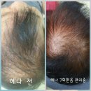 에이스테라피 이미지