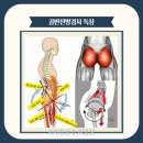 링게이트 이미지