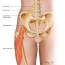 대퇴외측 경피신경 증후군 이미지