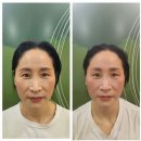 청주피부관리 &#34; 라라샵 &#34; 에서 통증케어받고 힐링하고 왔어여~