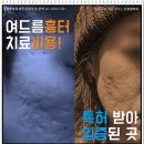 이진성형외과의원 | 여드름흉터치료비용 보다 믿을수 있는 곳에서 진행하자