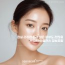 잠실 리쥬란 힐러 얇은 피부도 괜찮을까 hb플러스 정보포함