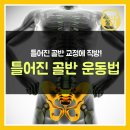 틀어진 골반 교정에 직방!골반 운동법 이미지