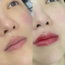 차성로 | 기장 입술문신 잘하는곳 헤세라 내돈내산 2차까지 솔직후기