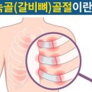 갈비뼈 금갔을때 늑골 골절 증상 치료 방법 이미지