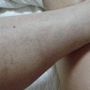 채피부과 이미지